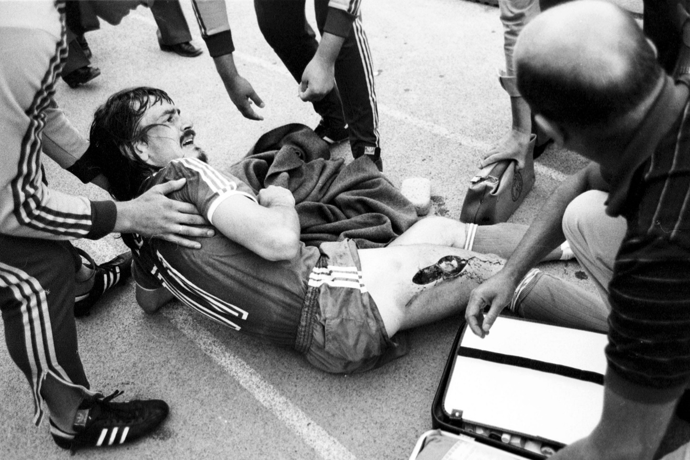 Norbert Siegmann schlitzt den Oberschenkel von Ewald Lienen am 14. August 1981 auf. Foto: Imago Images/Sven Simon